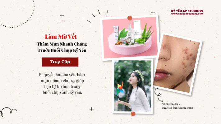 Làm mờ vết thâm mụn chụp ảnh Kỷ yếu